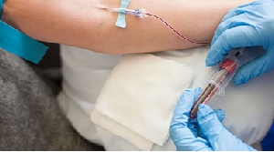 Cardiac Profile-By-A-Blood-Test